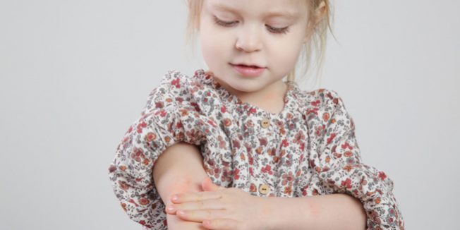 histamine-kids2_870x445